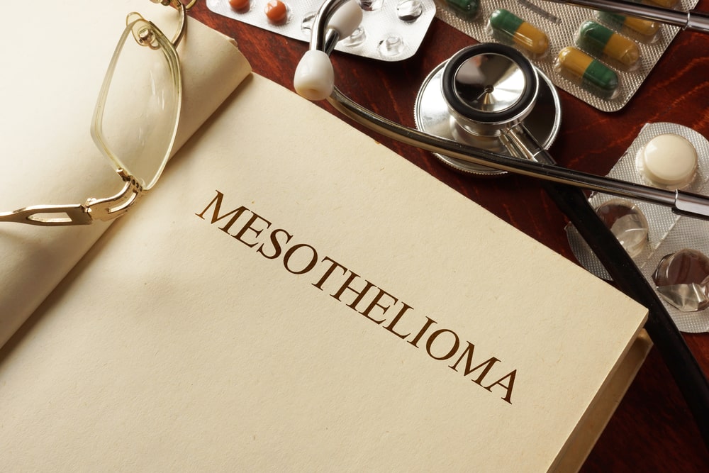 You are currently viewing Mesothelioma Lawsuits And You